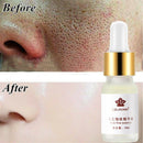Pore Shrinking Essence Tightening Oil-control Moisturizing Blackhead Remo ï¼D