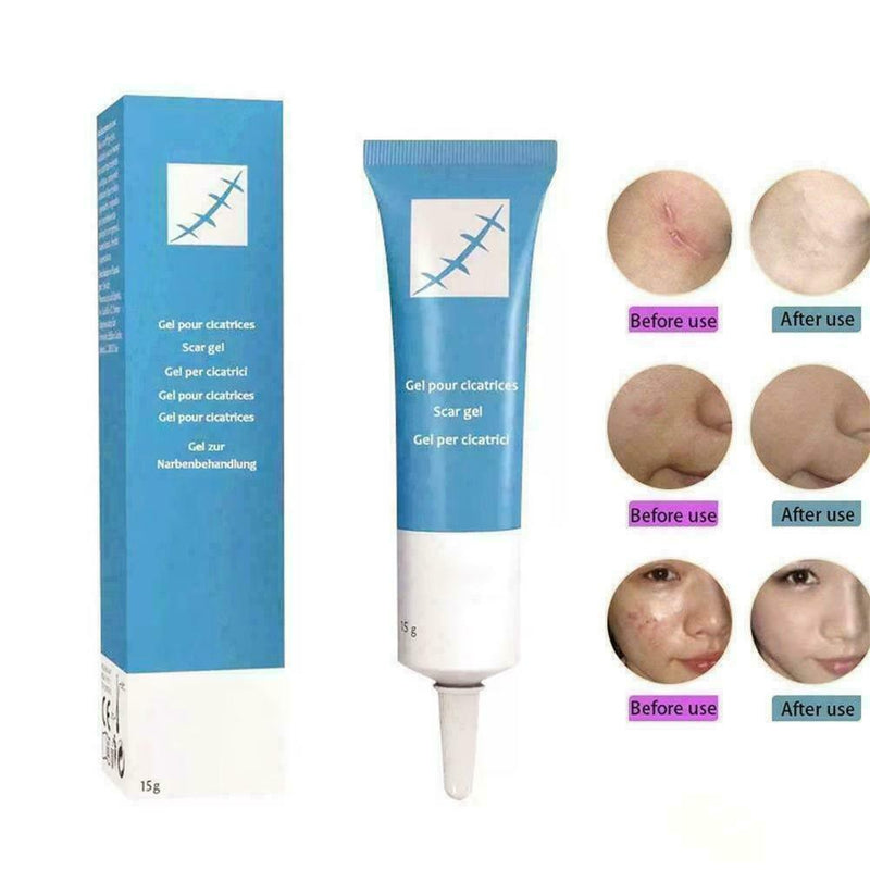 Universal Silicone Scar Remover Removal Serum Face Skin Burns Repair U2R1