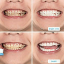 Toothpaste Stain Smoke Coffee Tea Removal Reduce Tooth Dirt Whitening Tooth