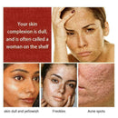 15ml Soins de la peau Blanchissant Huile Essentielle Vitamine S1Y0 SÃƒÂ©rum C W8Y2