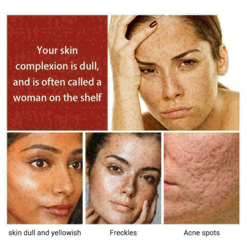 15ml Soins de la peau Blanchissant Huile Essentielle Vitamine S1Y0 SÃƒÂ©rum C W8Y2