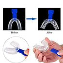 Snore Device Stop Snoring Sleep Aid Mouth Guard Device Sleep Aids Sale L0W9 W8Q2