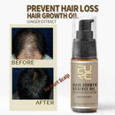 20ml PURC sale Fast Hair Growth Essence Oil Hair Loss K8B8 C Treatment M4Z4 P7R2
