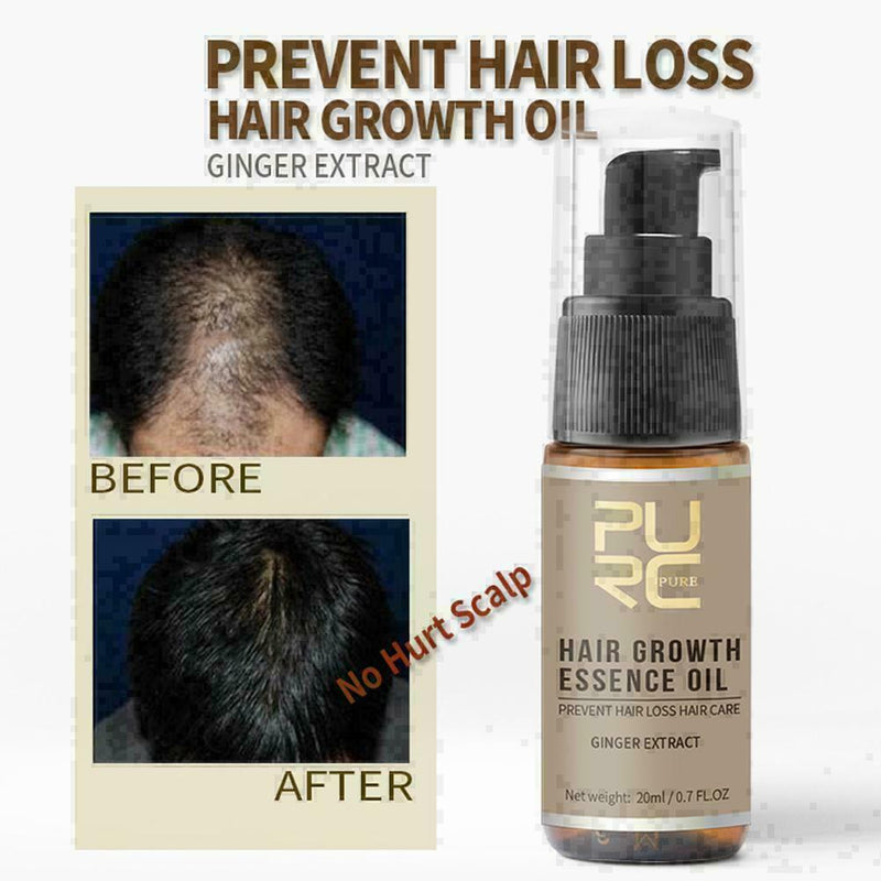 20ml PURC sale Fast Hair Growth Essence Oil Hair Loss K8B8 C Treatment M4Z4 P7R2