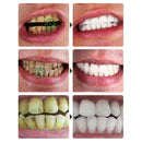 Teeth bright white pen teeth whitening remove plaque stains smoke stains B4 L7V8