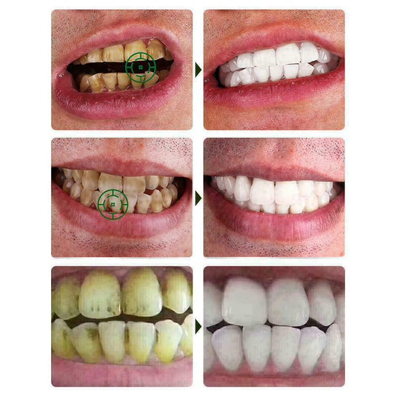 Teeth bright white pen teeth whitening remove plaque stains smoke stains B4 L7V8