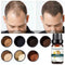 Ginger Fast Hair Growth Essence Essential Oil Anti-Hair Loss Fluid Hair Care