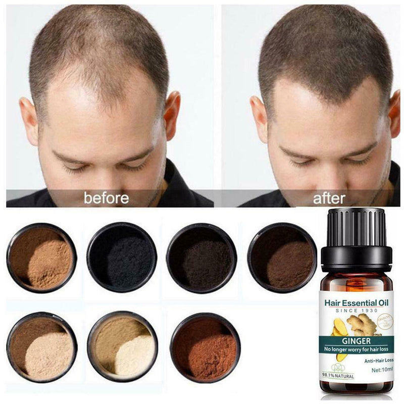 Ginger Fast Hair Growth Essence Essential Oil Anti-Hair Loss Fluid Hair Care