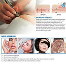 Dermabrasion Accessory Tip Diamond Microdermabrasion Replacement Skin Beauty Gw