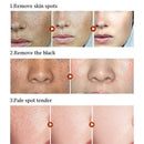 Beauty mole removal sweep Dark spot pen plasma Multifunction pen With Light LCD