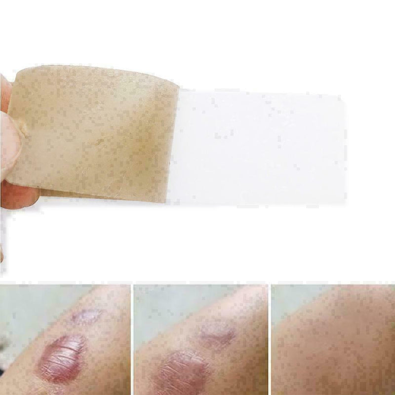 New Medical Scar Away Patch Silicone Gel Sheet Wound Treatmen Removal R0R3 Z2U3