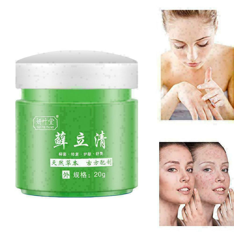 100% Natural Dry Irritable Itchy Skin Moisturiser K2R1 T5J9 R7W2 A1N8