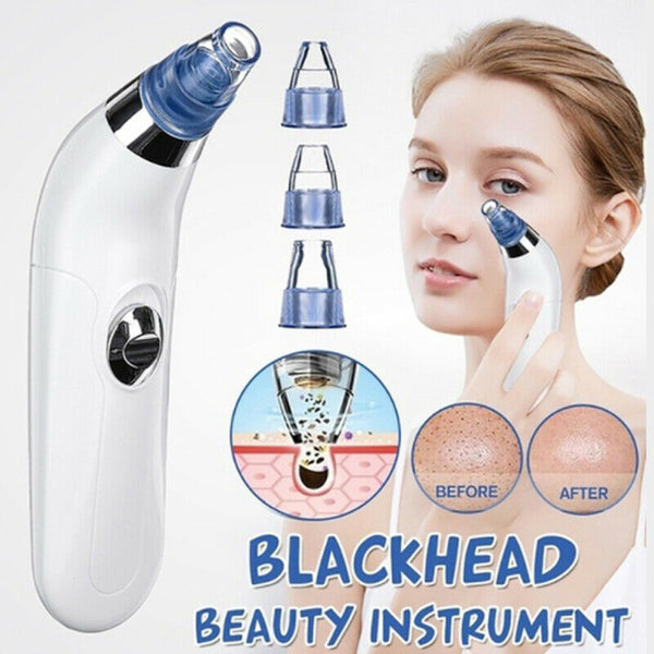 Electric Blackhead Vacuum Suction Acne Remover Face Pimple Pore Comedonew/Head