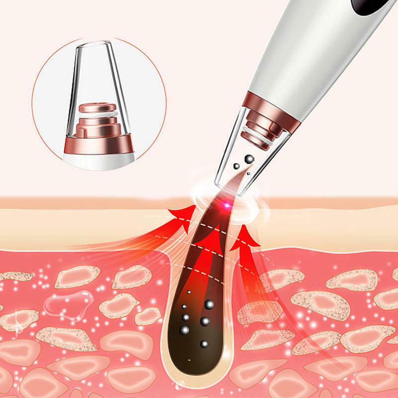1PC Electric Blackhead Instrument Acne Cleansing Face Pore Nose Cleaner Ar ZBI