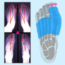 Big Toe Bunion Splint Hallux Valgus Foot Inflatable Corrector Straightener Foot