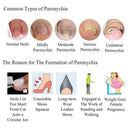 Lots 10 Ingrown Toenail Straightening Clip Toe Nails Correction Elastic Patches