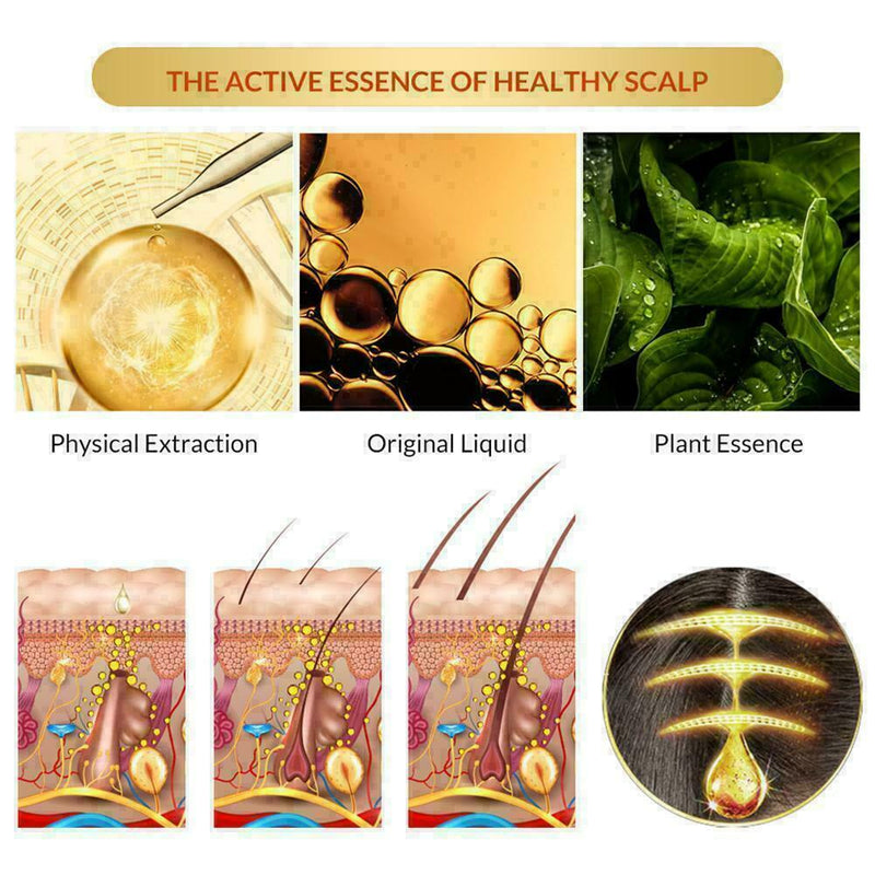 Anti Hair Loss Hair Growth Spray Essential Liquid Dry Repair Regeneration T Z4C9