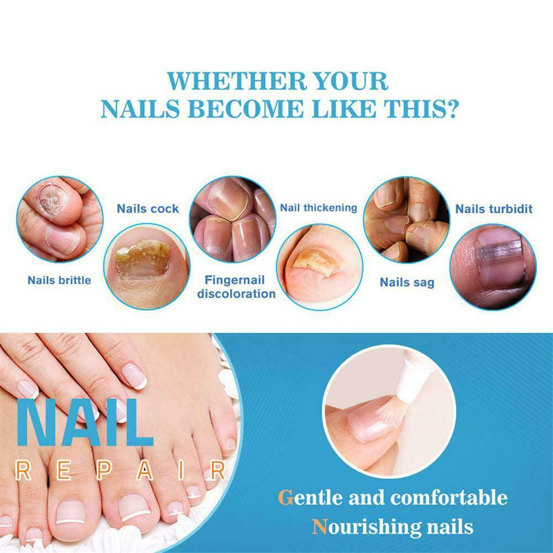 Nail Protection Liquid Repair Remove Liquid Bright Nails Gray Nail Pen