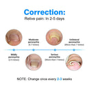 Perfect Foot Tool Set Ingrown Toenail Fixer Correction Toe Foot Repair Care B7Q3