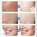 Daralis Face Exfoliating Mousse Shrink Pores Removal Blackhead Skin Care Fo