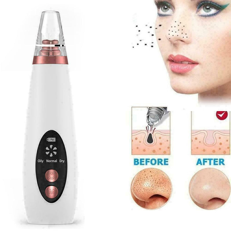 Blackhead Remover Skin Care Pore Vacuum Acne Pimple Clea Face Tool New Remo B0T7