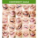 30g Instant Teeth Whitening Pens Extra Strong Teeth Cleaning Perfect Smile A8I2