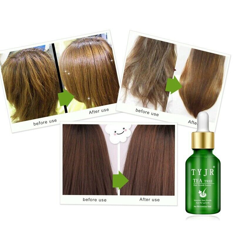 Tyjr Tea Tree Hair Growth Essence Nourishing Scalp Accelerate Hair Growth A J4H8