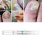 Herbal Nail Treatment Pen Nail Repair Fingernails Toenails Rich Nutrition