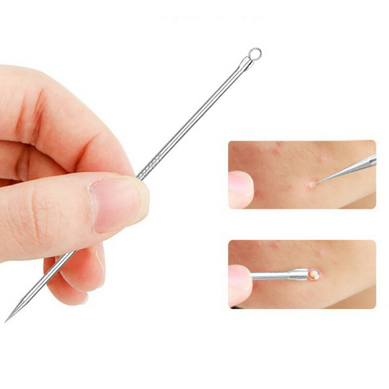 5x Blackhead Comedone Acne Blemish Remover Stainless Needles Remove Tool Kit.AU