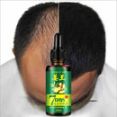 Loss Oil Care Hair For Women Men Ginger Restoration Hair Essence 30ml Treatment