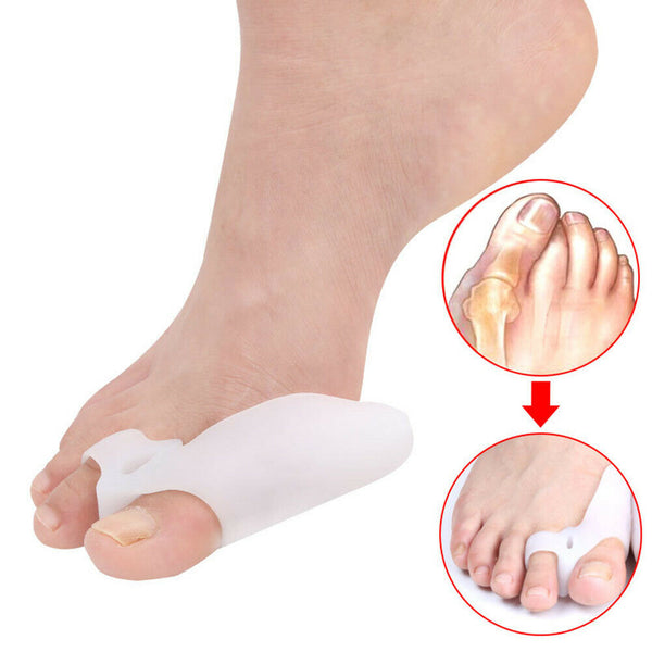 Hallux Valgus Toes Separator Kit Relieve Pain Bunion Corrector Foot Care