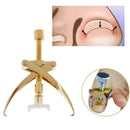 Professional Ingrown Toenail Correction Tools Stainless Steel Toe Nail Corrector