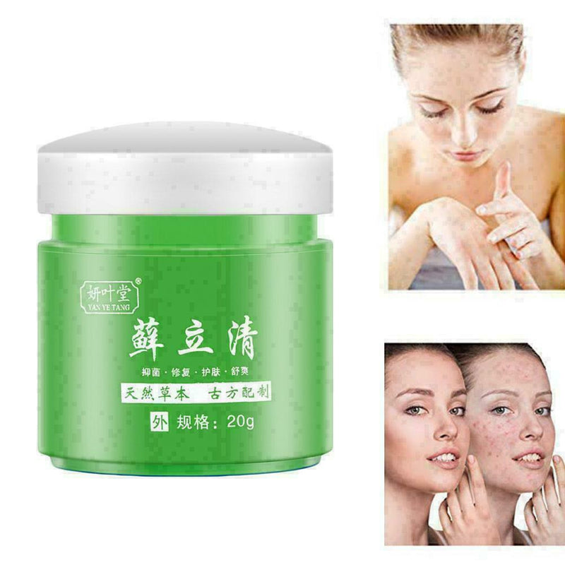 100% Natural Dry Irritable Itchy Skin Moisturiser W6Q9 F9O6 Y3V5