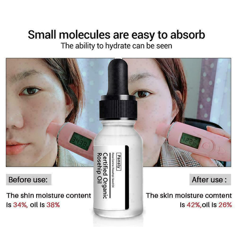 Rosehip Oil Moisturizing Essential Oil Rose Hip Skin Scars Acne Care Serum G1A2