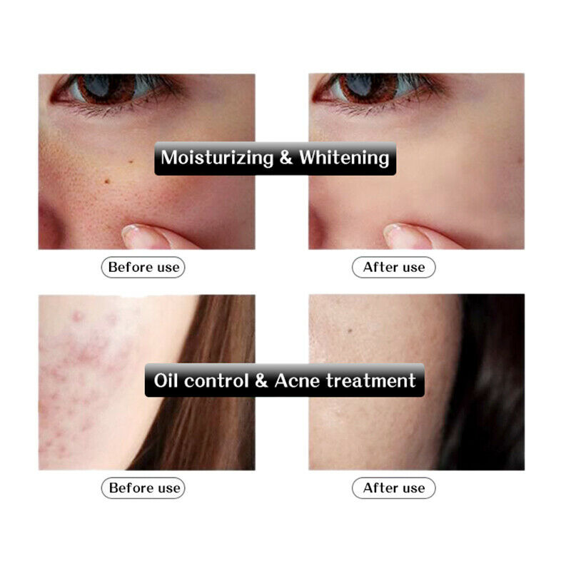 Rorec Serum Facial Hyaluronic Acid Essence Face Serum Skin Care Shrink Pore Y2A2