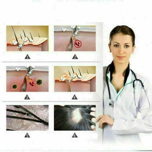 ReGrow 7 Day Ginger Germinal Hair Growth Serum Hairdressing Z5I0 Treate Los A1X3