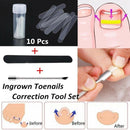 Ingrown Toe Nail Straightening Clip Brace Foot Care Toe Nail Correction Tool