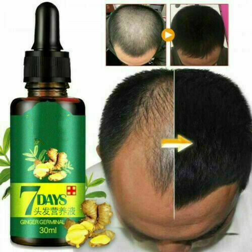 ReGrow 7 Day Ginger Germinal Hair Growth Serum Hairdressing Z5I0 Treate Los A1X3