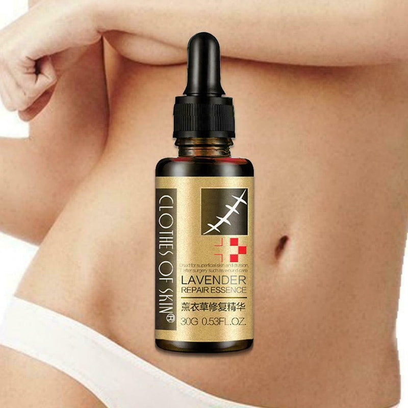 Lavender Essence Skin Care Natural Pure Remove Ance Mark Burn Strentch Remo H0D9