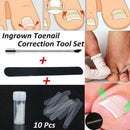10Pcs Ingrown Toenail Straightening Clip Curved Brace Glue With Kit Correct F2V4