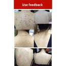 100G Sea Salt Soap Cleaner Removal Pimple Pores Acne Treatment Goat Milk Mo