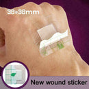 100PCS Hypoallergenic Non-woven  Adhesive Wound Dressing Bandage Ban I0Q5