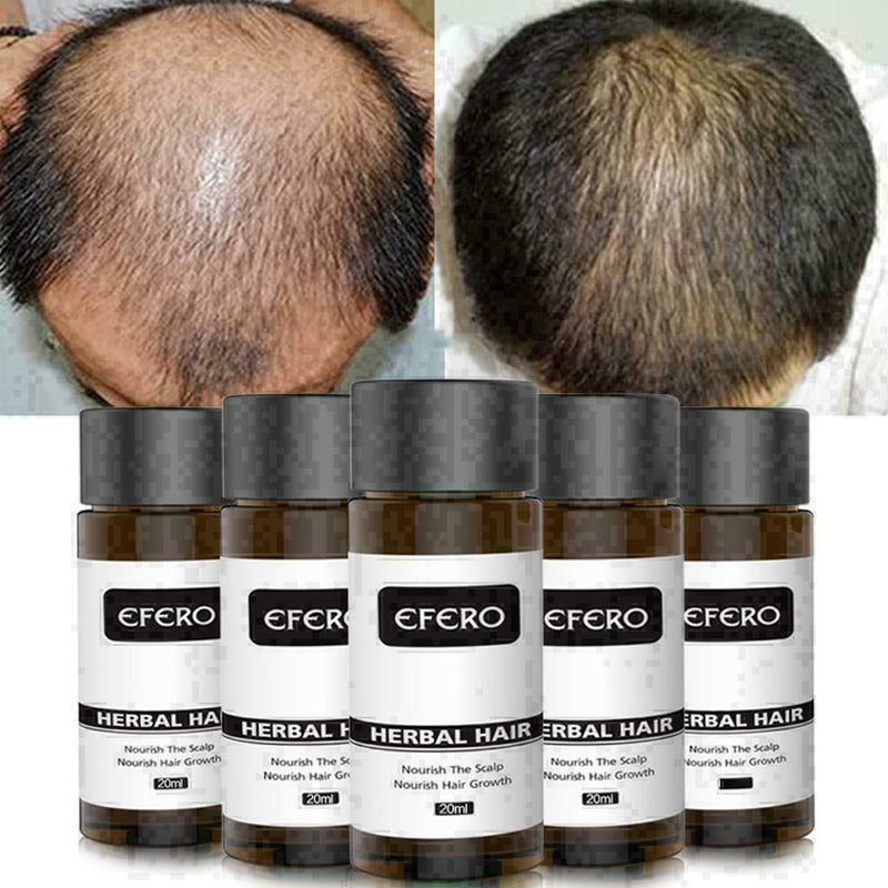 For Herbal Ginseng Raise Hair Growth Essence Hair Loss Treatment V2L8 U2E6 K6Y4