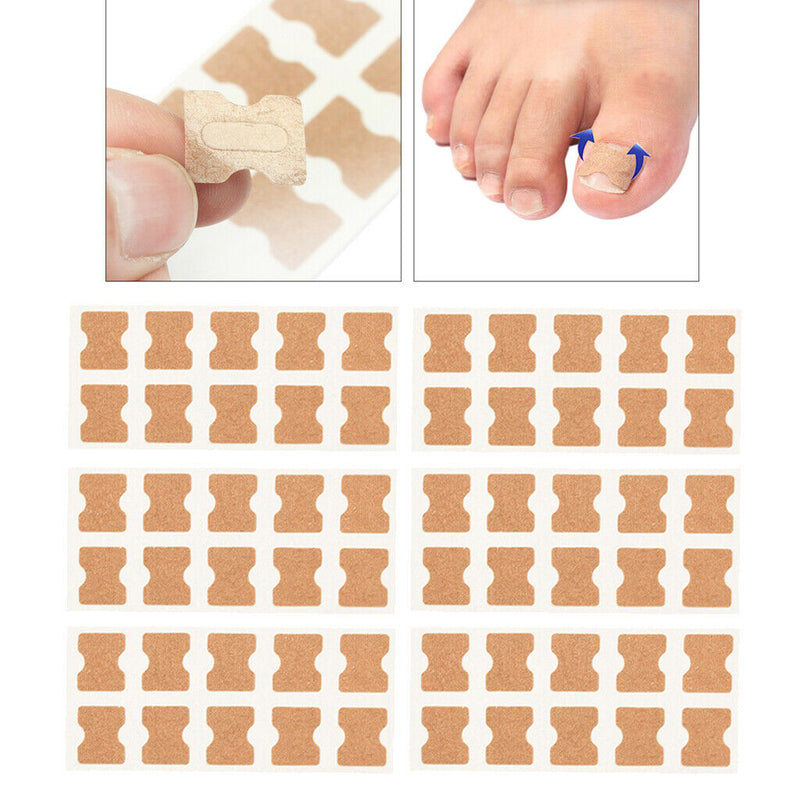 60Pcs Toenail Corrector Stickers Toe Nail Fixer Toe Nail Care Correction