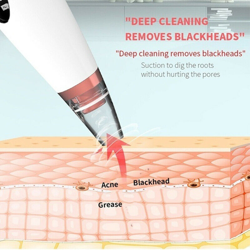 Blackhead Pimple Remover Face Pore Skin Care Acne Pore Cleaner Facial Tools