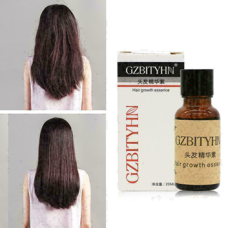 20ml Hair Care Growth Essence Anti Hair Loss Hairstyle Keratin Liquid Dense Y4F9