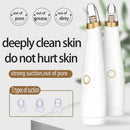 Electric Skin Care Facial Blackhead Remover Pore Suction Vaccum Cleanser Remover