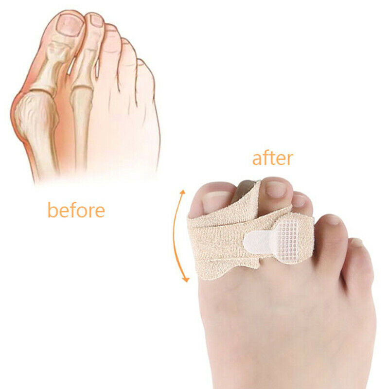 1 Pair/2Pcs Hallux Valgus Separator Orthoses Toes Corrector Adjuster Feet Car Kw