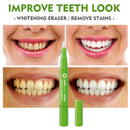30g Instant Teeth Whitening Pen Extra Strong Teeth Cleaning Perfect Smile HOT