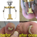 Ingrown Toenail Pedicure Tool Straightening Clip Curved Brace for Toenails Foot